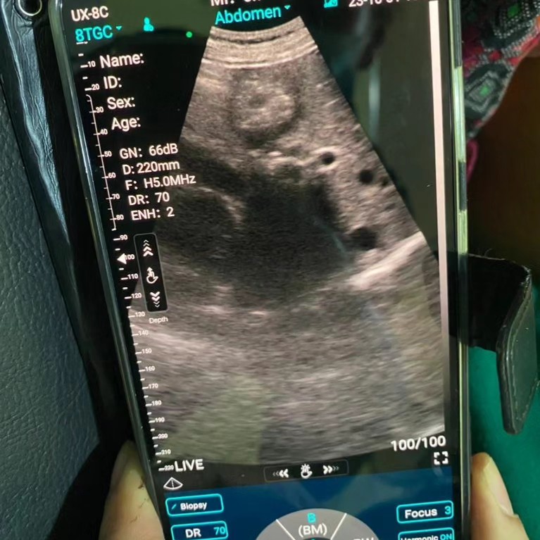 New portable technolgy shows ultrasound results